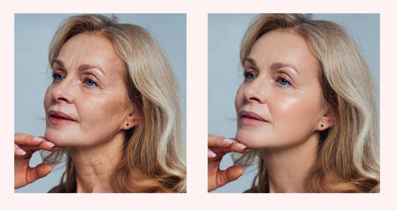 AI Consultant After